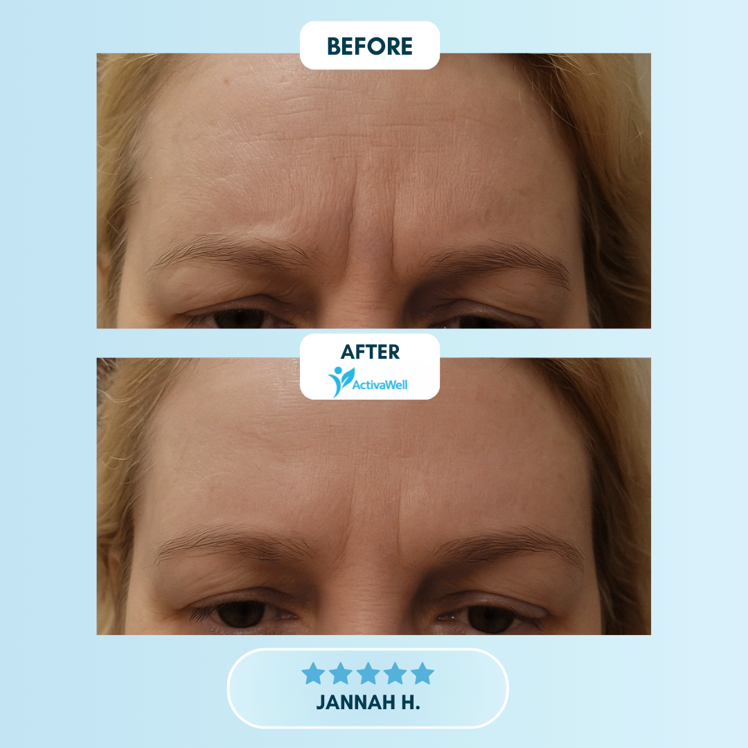 ActivaWell™ - Silicone Collagen Sheets
