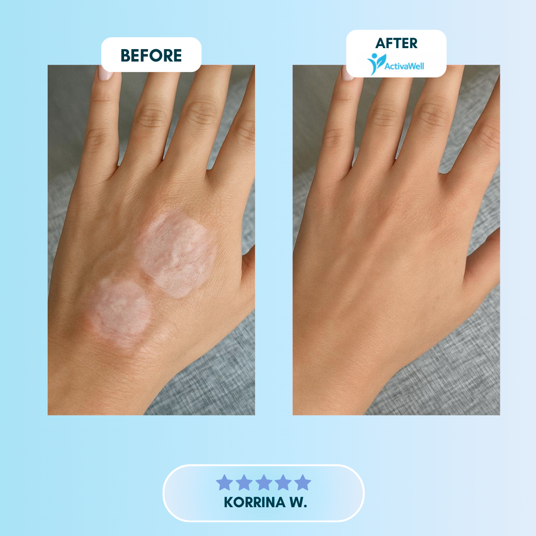 ActivaWell™ - Silicone Collagen Sheets