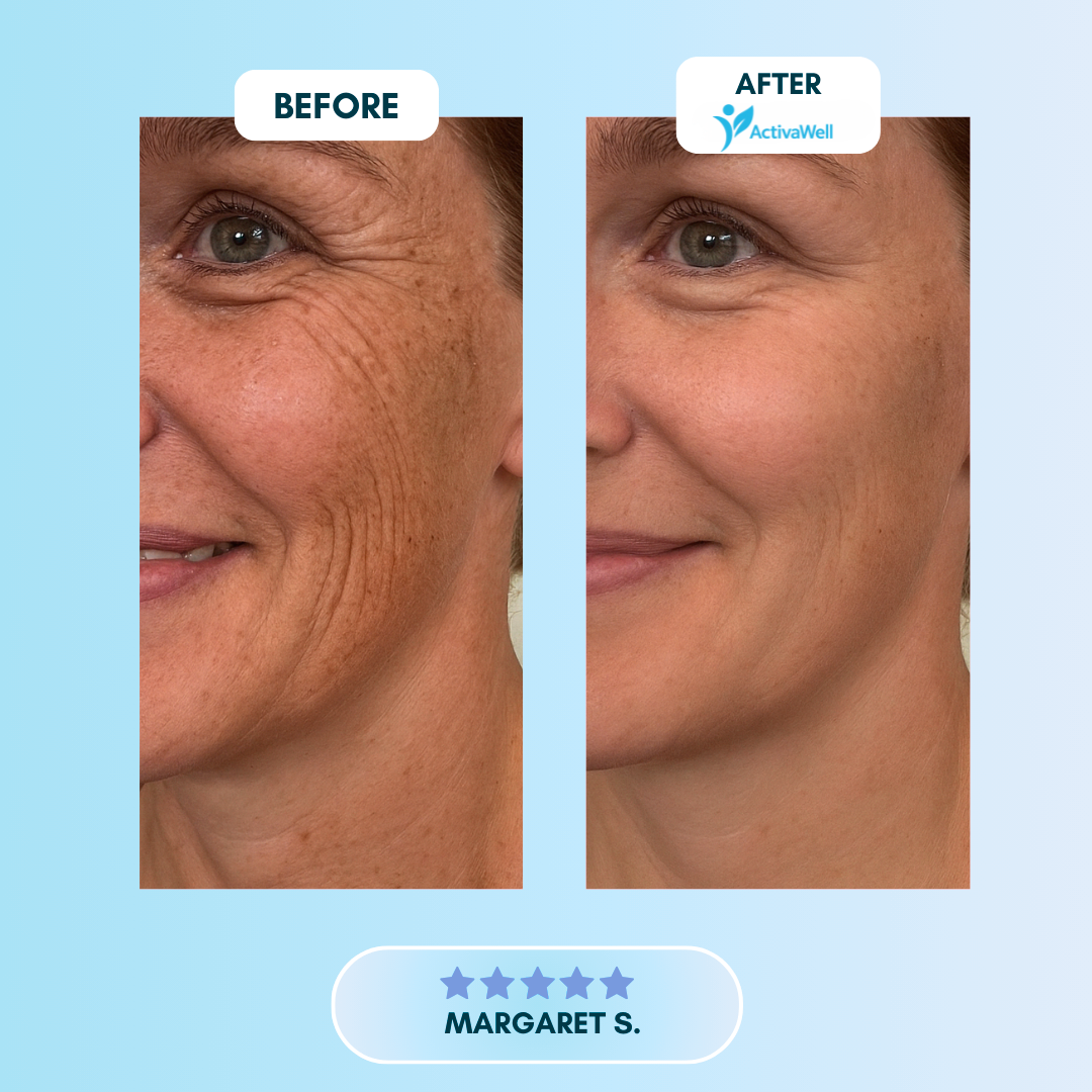 ActivaWell™ - Silicone Collagen Sheets