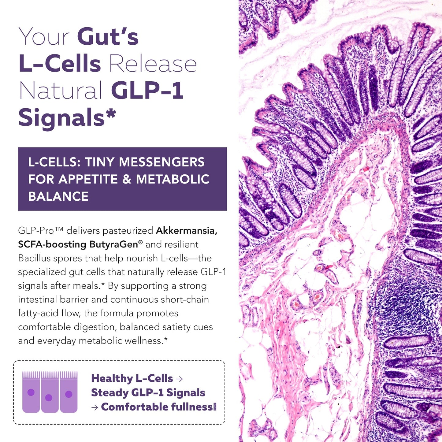 GLP-Pro | GLP-1 Probiotic & Postbiotic
