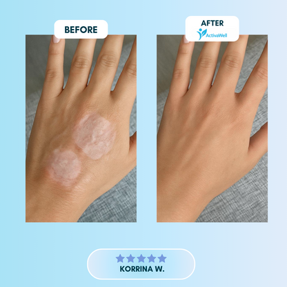 ActivaWell™ - Silicone Collagen Sheets