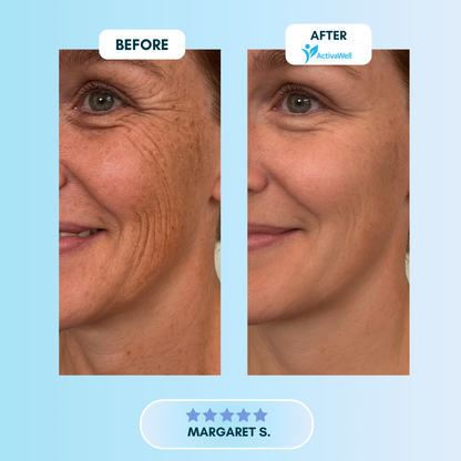 ActivaWell™ - Silicone Collagen Sheets